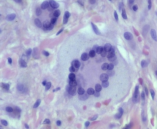 Επιλέχθηκε εικόνα