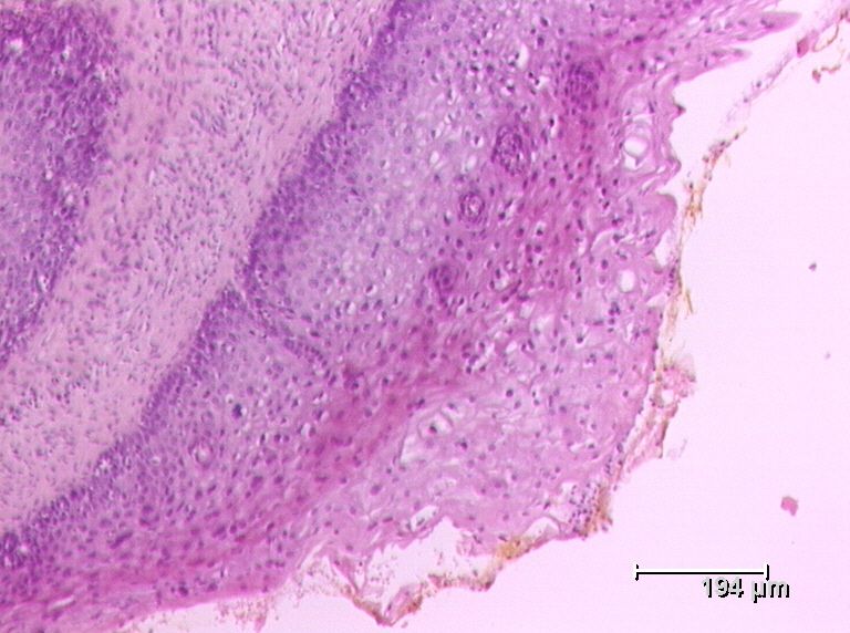 Επιλέχθηκε εικόνα